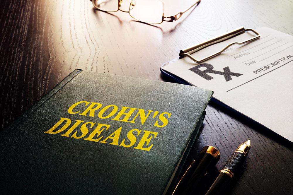 Top 10 early warning signs of Crohn’s